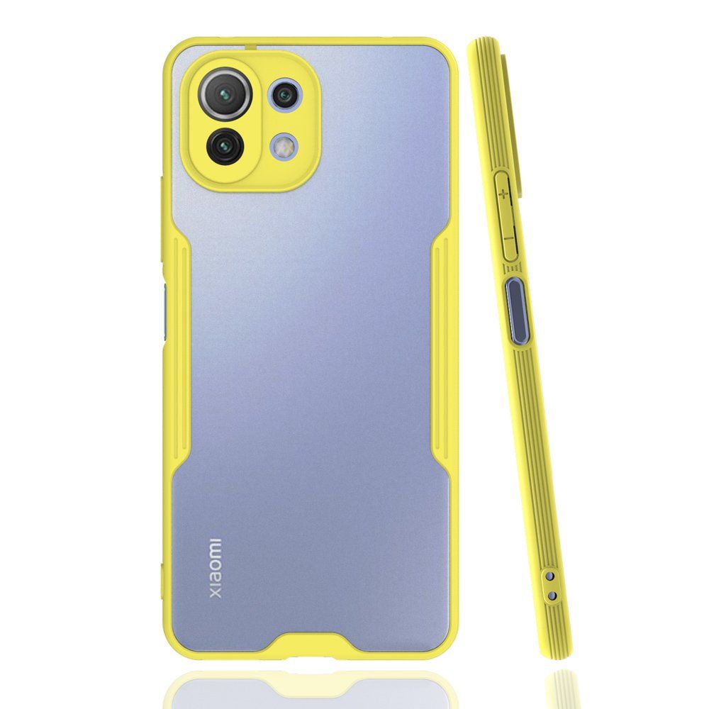 Xiaomi Mi 11 Lite Kılıf Platin Matte Silikon Arka Kapak